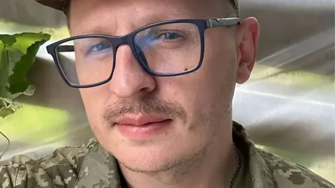 Сергій Мартинюк переніс операцію на голосових зв'язках